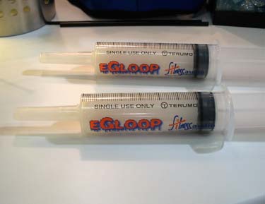 E-Gloop